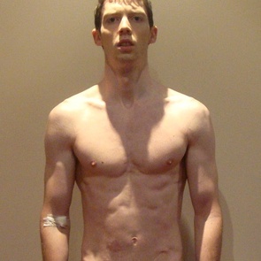 Peter K out of hospital Jan 2012